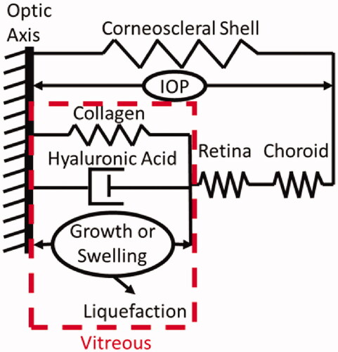 Figure 1. Schematic of internal tension theory of vitreous biomechanics. Tension generated by the swelling pressure of the vitreous mechanically tamponades the retina and ensures approximation with the choroid against the corneoscleral shell. Vitreous liquefaction leads to reduced swelling pressure of the biological hydrogel and therefore reduced tension in the elastic collagen of the vitreous.