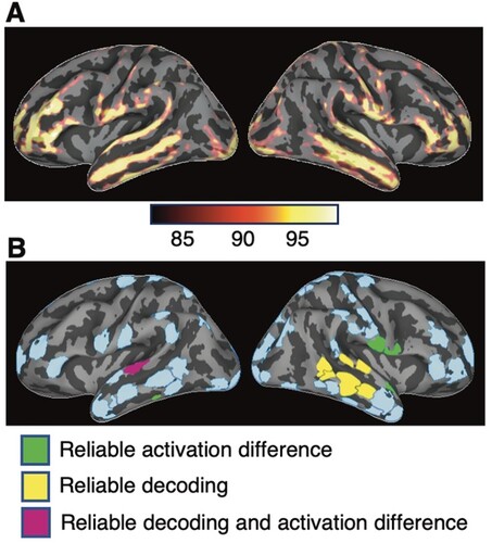 Figure 1. Event-related cortical activation and regions of interest (ROIs). (A) Spatial distribution of estimated activity, averaged across all conditions and subjects for the interval of 100–500 ms after the stimulus onset. The activity is visualised on the lateral view of averaged inflated cortical surfaces. The colour scale indicates the percentile of the activation magnitude among all source locations. (B) ROIs identified based on the estimated spatiotemporal patterns of activity. Colour coding indicates regions that in subsequent analyses showed reliable activation differences (green), successful decoding (yellow), or both (magenta, region L-STG1) across all reduplication pattern contrasts. The other regions (pale blue) showed neither activation differences nor decoding. Descriptive names and locations of the ROIs are given in Figure S1 and Table S1.