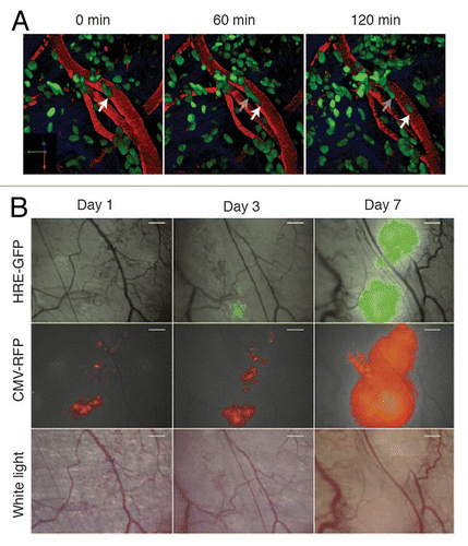 Figure 1. Intravital microscopy of tumors through imaging windows. (A) A 3D reconstruction of a murine orthotopic glioma (GL261-H2B Dendra2). The time-series show single cells migrating along the vessels. Nuclear localization of the photoprotein allows accurate single cell tracking. Green: tumor cell nuclei; Red: Dextran-labeled vasculature. Scale bar, 12 µm. (B) 4T1 tumor cell growth was visualized at day 1, 3 and 7 following tumor implantation through the dorsal skinfold chamber. A HIF-1 reporter (HRE-GFP) was expressed in tumor cells (CMV-RFP) and both were visualized using fluorescence microscopy. The vasculature is shown in red and was visualized using white light. Scale bar, 300 µm. Reprinted fromCitation102 with permission from Elsevier.