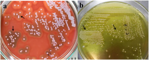 Figure 1. The image depicts the pure isolates of S. pseudintermedius; the blood agar (1a) illustrates the phenotypic appearance (round, smooth, non-pigmented or grey-white) and different hemolytic properties (alpha, beta, and double hemolysis). In addition, mannitol salt agar (1b) demonstrates the fermentation of mannitol sugar and characteristic changes of media color.