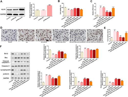 Figure 4 KLF9 overexpression weakens the effects of miR-106a mimic on HG-induced MPC5 podocytes. (A) Representative blots and quantitative analysis for KLF9 (n=3). ***P<0.001 vs control group. (B) The cell viability of MPC5 in different groups (n=3). ***P<0.001 vs control group. #P<0.05 vs HG + miR-NC. ΔP<0.05 vs HG + miR-106 mimic + pcDNA-NC. (C) The ROS level in MPC5 relative to control group (n=3). ***P<0.001 vs control group. ###P<0.001 vs HG + miR-NC. ΔΔΔP<0.001 vs HG + miR-106 mimic + pcDNA-NC. (D and E) Representative images (D) and quantitative analysis (E) for TUNEL staining, apoptotic cells were stained with dark brown (×200). ***P<0.001 vs control group. ###P<0.001 vs HG + miR-NC. ΔΔΔP<0.001 vs HG + miR-106 mimic + pcDNA-NC. (F) Representative blots and quantitative analysis for Bcl-2, Bax, caspase 3, synaptopodin and podocin (n=3). ***P<0.001 vs control group. ###P<0.001 vs HG + miR-NC. ΔP<0.05, ΔΔP<0.01, ΔΔΔP<0.001 vs HG + miR-106 mimic + pcDNA-NC.
