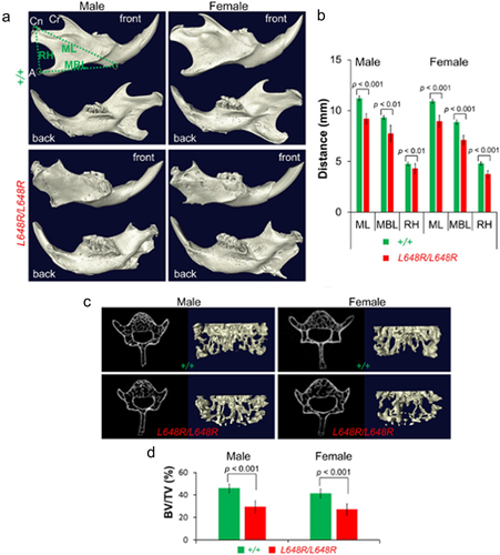 Figure 5. Bone defects in male and female LmnaL648R/L648R mice. (a) Representative 3D renderings of the segmented micro-CT – scanned images showing mandibles of male and female Lmna+/+ (+/+) and LmnaL648R/L648R (L648R/L648R) mice. A: angular process; cn: condylar process; cr: coronoid process; MBL: mandibular body length; ML: mandibular length; RH: ramus height. (b) comparisons of ML, MBL, and RH between male +/+ and L648R/L648R mice and between female +/+ and L648R/L648R mice. Values are means and error bars indicate standard errors. (c) Representative micro-CT – scanned transverse sections and 3D reconstructions of the L5 vertebrae from male and female +/+ and L648R/L648R mice. (d) comparison of vertebra L5 bone density (bone volume/total volume; BV/TV %) between male +/+ (n = 5) and L648R/L648R (n = 5) mice and between female +/+ (n = 7) and L648R/L648R (n = 6) mice. Values are means and error bars indicate standard errors. Figures are from Wang et al. [Citation103].