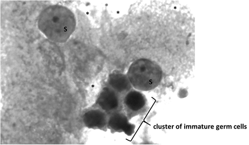 Figure 1. Morphology of testicular germ cells showing a cluster of immature germ cells, Sertoli cells (S), and various lipid inclusions (*) (unstained). Olympus IX71 inverted microscopy (400X)