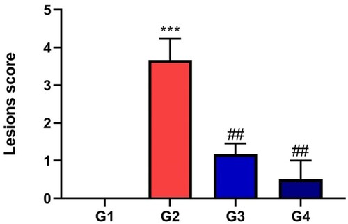 Figure 6. Hepatic steatosis lesion score of different groups expressed mean ± SD, * indicates significance in comparison with control group G1 and # indicates significance in comparison with diseased group G2, P < 0.05.