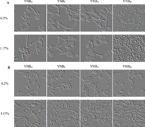 Figure 3. Cell morphology of T. cutaneum B3 cultivated on YNB-based medium with 0.2% and 1.17% of the different of carbon sources. (A) Cultivation on non-buffered YNB-based medium and (B) cultivation on citrate-buffered YNB-based medium (pH 6.0). The cells were photographed at 1000× magnifications after 72 h growth on the medium and the inoculum was 100% yeast-like cells. YNBG, YNB-based medium plus glucose; YCBF, YNB-based medium plus fructose; YNBX, YNB-based medium plus xylose; YNBN, YNB-based medium plus N-acetylglucosamine.