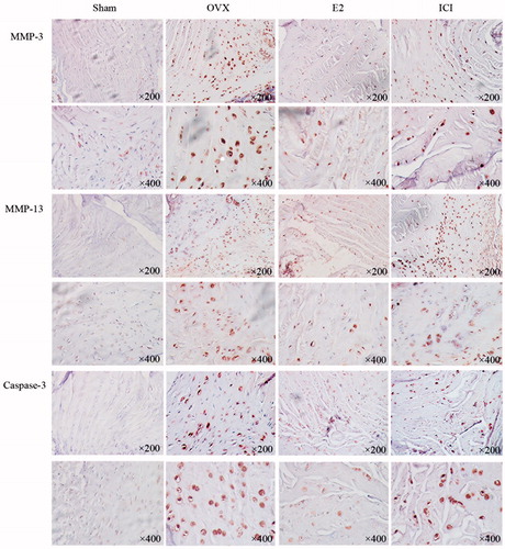 Figure 7. Immunohistochemistry was performed to detect the expression of caspase-17, MMP-3 and MMP-13. Forty 3-month-old female Sprague Dawley rats were randomly divided into four groups: Sham, OVX, E2, ICI. Sham group only underwent the resection of a bit of fat; OVX group underwent bilateral ovariectomy; E2 group was treated with 17β-Estradiol based on OVX; ICI group was treated with 17β-Estradiol and pretreated ICI182780 (inhibitor of the estrogen receptor) based on OVX ((Mean ± SD; n = 10). MMP-3: matrix metalloproteinase-3; MMP-13: matrix metalloproteinase-13; E2: 17β-Estradiol. *p < .05).
