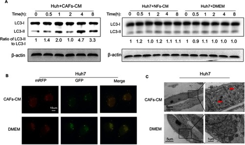 Figure 3 CAFs increase autophagy in HCC cells. (A) Western blotting was performed to detect LC3I/II expression after Huh7 cells were cultured in CAFs-CM over time. (B) Huh7 cells that steadily expressed mRFP-GFP-LC3 fusion protein were co-cultured in CAFs-CM. Immunofluorescent microscopic images were shown. Bar scale, 10 um. (C) Autolysosomes were observed by transmission electron microscopy in Huh7 cells treated with CAFs-CM.Abbreviations: HCC, hepatocellular carcinoma ; CAFs, cancer-associated fibroblasts; CM, conditioned medium.