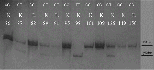 Figure 1. PAGE for visualization of PCR-RFLP products and genotyping for MMP2 −1306C>T. The homozygous CC carriers were determined with one visible band of 188 bp (K86, K88, K95, K101, K109, K149, K150); the heterozygous CT carriers with two visible bands of 188 bp and 162 bp (K87, K89, K91, K125) and the homozygous TT carriers with one visible band of 162 bp (K98).
