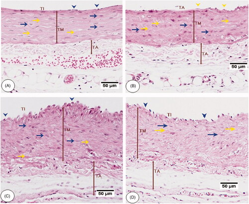 Figure 6. Aorta histopathology of control rats fed a standard (STD) and high-fat diet (HFD) rats. A and B were taken from a control rat fed STD, and a control rat fed STD and co-treated with C. aronia, respectively. All layers including tunic intima (TI), media (TM), and adventitia (TA) were visible with normal diameter and appearance. Endothelial cells are visible in the surface of the vessel lumen (blow arrowheads), and the medial SMCs of the tunica media are oriented horizontally to the aortic canal (blue arrow). Abundant and well-formed elastic fibres were displayed in a lamellar pattern (yellow arrow), and the TA shows few elastic fibres in the form of a loose network. C and D were taken from HFD-fed rats, and show showed disturbance and proliferation of tunica TI layer, the disorientation of SMCs with unclear borders and loss of elastic lamellae architecture. They also show the markedly increased thickness of TM and TA. H&E, 200×