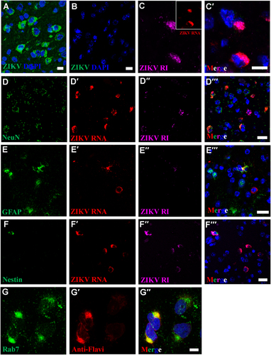 Fig. 2 ZIKV multiplies in replication factories of diverse brain cell types in C57BL/6 laboratory mice 7 or 8 days after IP  exposure to 6.4 log10 PFUs of ZIKV strain DarArD 41525. (a–b) IFA using anti-ZIKV E antibody reveals perinuclear ZIKV replication factories in infected (a), but not in uninfected mouse brains (b). c–c′ Perinuclear ZIKV replication factories were  revealed by multiplex FISH detecting ZIKV genomic (inset, red) or antigenomic RNA (magenta). (d–f′′) Multiplex FISH detection of ZIKV replication factories in neurons (Rbfox3/NeuN), glial cells (GFAP), and neuroectodermal stem cells (Nes). (g–g′′) Colocalization of ZIKV particles and endosomes were revealed by IFA using anti-flavivirus antibody (red) and anti-Rab7 antibody (green). Nuclei were stained with DAPI (blue). Scale bar, 10 µm (a–c′, g–g′) and 20 µm (d–f′)