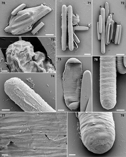Figs 70–78. Pinnularia cf. gibba, SEM. Figs 70–74. Fixed, critical-point-dried material. Fig. 70. Organic envelope surrounding gametangia and expanded auxospores. Fig. 71. Expanded diploid auxospores. Fig. 72. Diploid auxospore (d), two haploid auxospores (h, one almost obscured) and four dehisced gametangia. Fig. 73. Detail of crumpled zygote with organic wall. Fig. 74. Expanded auxospore with slightly pleated organic layer overlying siliceous elements. Figs 75–78. Oxidized auxospore walls. Fig. 75. Early stage in auxospore expansion with closely packed, parallel incunabular strips in the collapsed central zone; the auxospore poles are more robust. Fig. 76. Mature auxospore, with widely spaced incunabular strips separating to reveal the perizonium beneath. Fig. 77. Detail of incunabular strips; note that some have free ends (e.g. arrow). Fig. 78. Detail of auxospore pole, showing elliptical and polygonal scales of the incunabula. Scale bars: 20 µm (Figs 70–72), 5 µm (Figs 74–76) or 2 µm (Figs 73, 77, 78).