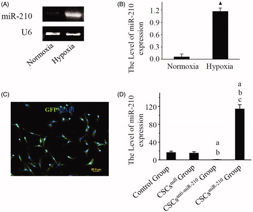 Figure 1. The identification of miR-210 expression. Representative RT-PCR photographs of miR-210 and U6 expression in CSCs are shown in A, and comparison of the ratio of miR-210 to U6 between normoxia and hypoxia is performed in B. C displays the representative photo of GFP expression in CSCs after transfection. D shows representative photographs for the ratio of miR-210 expression to U6 in CSCs. B and D present mean values and SD from three independent observations. GFP: Green fluorescent protein. CSCs: Cardiac stem cells. ▲ P < .001 vs. Normoxia. a: P < .001 vs. Control Group. b: P < .001 vs. CSCsnull Group. c: P < .001 vs. CSCsanti-miR-210 Group.