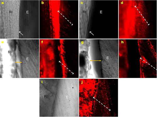 Figure 5 Micrographs obtained by confocal laser scanning microscopy in fluorescence mode, for analysis of the resin infiltrant penetration. (a and b) Icon (IC); (c and d) PE; (e and f) Bio5; (g and h) Bio10; (i and j) Hap10.