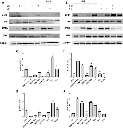 Figure 9 Effect of therapeutic strategies in ERK and MEK protein levels. Western blot analysis of phosphorylated (p) and total (t) ERK, and phosphorylated (p) and total (t) MEK in HepG2 (A, C and D) and Hep3B (B, E and F) cells after being treated, with empty HNP; HNP containing only selumetinib or sorafenib; HNP containing sorafenib and selumetinib; or with free drugs (A–F); 8 μg of HNP or the corresponding free drug concentrations were added to each well of 6-well plates. Representative Western blot images displaying the levels of p/t-ERK and p/t-MEK in HepG2 (A) and Hep3B (B) cells. Graphical representation of the p-ERK/t-ERK (C and E) and p-MEK/t-MEK (D and F) ratios in HepG2 and Hep3B cells. Data are expressed as mean ± SD obtained from three independent experiments (n=3). (***P < 0.001); (**P< 0.01); (*P< 0.05) Denotes a statistically significant difference when compared with cells treated with hybrid nanosystems containing sorafenib and selumetinib.