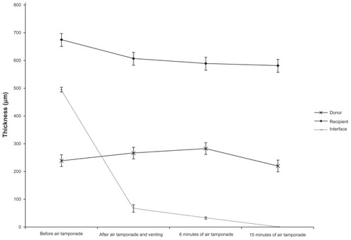 Figure 2 Intraoperative estimated mean thickness of the donor lenticule, recipient cornea, and interface fluid during Descemet’s stripping and automated endothelial keratoplasty.