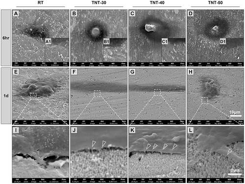 Figure 4 Representative SEM images illustrating adhesive morphology of HGFs on different surfaces. At 6 hr of cell culture, though still round-shaped, compared with RT, HGFs on nanotubes array (TNT-30/40/50) appeared to have plenty of pseudopodia extending from cell membrane (A–D, pseudopodia details in A1–D1). Later at 1 d of cell culture, compared with HGFs whose morphology have not fully spread on RT and TNT-50 (E and H), cells on TNT-30 and 40 spread terminally and turned to be spindle shaped (F and G). In higher magnification of dotted squares in panel (E–H), HGFs extended tiny protrusions (triangles in panel J–L) into the holes of the nanotube-containing surfaces (I–L).
