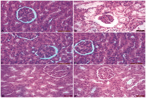 Figure 1. The normal histopathological structure of kidney tissue of the control (K) group (A). Atrophy in the glomerulus, dilation in Bowman's capsule and tubulus, severe hydropic degeneration of tubular epithelium, coagulation necrosis, tubule epithelium scattered on tubular lumen histopathological structure of kidney tissue of the CCl4 (C) group (B). Histopathological structure of kidney tissue of Silybum marianum (SM) group (C). Histopathological structure of kidney tissue of Taraxacum officinale (TO) group (D). Silybum marianum+ CCl4 (SM + C) group: kidneys, hyperemia, and degeneration in very few numbers of tubular epithelium (E). Taraxacum officinale+ CCl4 (TO + C) group: mild hydropic degeneration of tubular epithelium, very few numbers of necrotic cells (F) HxE, Bar: 20 μm.