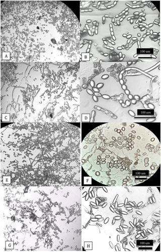 Fig. 7 Light microscopic images of spores of Podosphaeria and Golovinomyces from cannabis, squash and hop plants. Clear sticky cellophane tape was gently pressed onto the leaves and transferred to a microscope slide which was examined under a compound microscope at various magnifications for characteristics of conidia and chains. (a, b) Conidia and chains of P. macularis from cannabis plants ‘Chronic Ryder’. (c, d) Conidia and chains of P. xanthii from squash plants. (e, f) Conidia of P. macularis from hop leaves. (g, h) Conidia of G. ambrosiae from cannabis leaves.