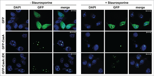 Figure 6. Deletion of the EK repetition motif does not alter intracellular localization of CaeA. Representative immunofluorescence micrographs show CHO-FcR cells transiently transfected with GFP, GFP-CaeA and GFP-CaeAΔEK. The cells were treated with or without 1 µM staurosporine for 6 h at 37°C in 5% CO2 followed by fixation, permeabilization and staining of the nuclei with DAPI (blue).
