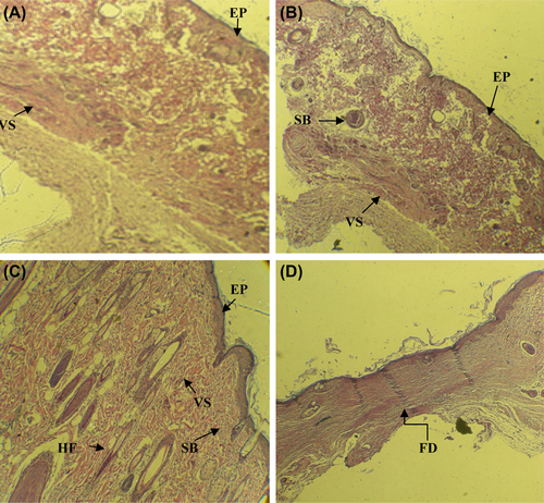 Figure 5. Histology of wounds by H&E staining in different groups on post-operative day 21. (A) nanofibrous PCL scaffold (B) Laminin-coated nanofibrous PCL scaffold (C) Laminin-coated nanofibrous PCL scaffold with USSCs (D) Control (Abbreviations: FD, fibrous debris; EP, epithelialization; HF, hair follicle; SB, sebaceous gland; VS, vascularized section).