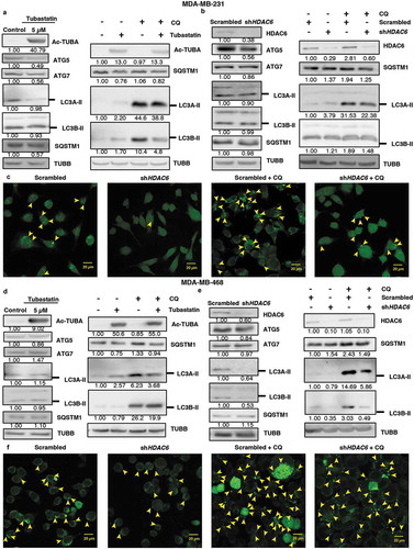 Figure 6. HDAC6 inhibition or KD inhibit autophagy in MDA-MB-231 and MDA-MB-468 cells. (a) MDA-MB-231 tubastatin A-treated cells were subjected to western blot analysis for ATG5, ATG7 LC3A-II, LC3B-II and SQSTM1 and treated with 18 µM chloroquine (CQ), and the levels of SQSTM1, and LC3-II were analyzed by WB analysis. (b) MDA-MB-231 HDAC6 KD cells were subjected to WB analysis for ATG5, ATG7, LC3A-II and LC3B-II and SQSTM1 and scrambled control or shHDAC6 KD cells were treated with 18 µM chloroquine (CQ) and the levels of SQSTM1, and LC3-II were analyzed by WB analysis. (c) MDA-MB-231 HDAC6 KD cells were transfected with GFP-LC3-overexpressing plasmid and treated with chloroquine (CQ) and puncta formation was analyzed by confocal microscopy. Arrowheads indicate examples of GFP-LC3 puncta. (d) MDA-MB-468 tubastatin A-treated cells were subjected to western blot analysis for ATG5, ATG7, LC3A-II, LC3B-II and SQSTM1 and treated with 18 µM chloroquine (CQ) and the levels of SQSTM1, and LC3-II were analyzed by WB analysis. (e) MDA-MB-468 HDAC6 KD cells were subjected to WB analysis for ATG5, ATG7, LC3A-II, LC3B-II and SQSTM1 and scrambled control or shHDAC6 KD cells were treated with 18 µM chloroquine (CQ) and the levels of SQSTM1, and LC3-II were analyzed by WB analysis. (f) MDA-MB-468 HDAC6 KD cells were transfected with GFP-LC3-overexpressing plasmid and treated with chloroquine (CQ) and puncta formation was analyzed by confocal microscopy.