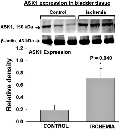 Figure 2 The expression levels of ASK1 was significantly greater in the ischemic bladder tissues in comparison with bladder tissues from sham controls. ASK1 is a cellular stress sensor that determines the cells fate following exposure to stressful stimuli by regulating fundamental cellular functions in response to redox engendered by the ischemic conditions. Upregulation of ASK1 in bladder ischemia suggests cellular stress responses triggered by lack of perfusion, nutrient deficiency and hypoxia that seem to incite degenerative processes via apoptotic insult. * represents significant change in the ischemic tissues versus controls.