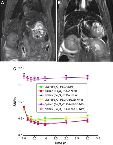 Figure 8 MRI T2WI images of the abdomen and graph of SNRs.Notes: (A) Before injection of the Fe3O4-PLGA-cRGD NPs. (B) After injection of the Fe3O4-PLGA-cRGD NPs at 30 min. (C) SNRs curves of the liver, spleen, and kidneys before and after the injection of Fe3O4-PLGA and Fe3O4-PLGA-cRGD NPs. MRI T2WI images of the abdomen demonstrated that the signals in the liver and spleen decreased significantly after NP injection. The SNRs of both the liver and spleen decreased significantly after NP injection as well, and the SNRs of the kidney decreased slightly.Abbreviations: cRGD, cyclic Arg-Gly-Asp; MRI, magnetic resonance imaging; NPs, nanoparticles; PLGA, poly(lactic-co-glycolic acid); SNRs, signal-to-noise ratios; T2WI, T2-weighted imaging.