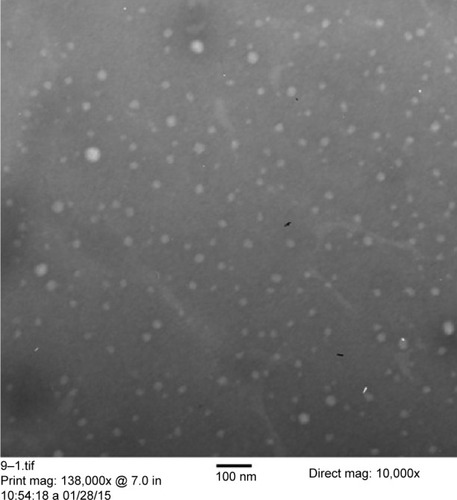 Figure 3 TEM image for the optimized finasteride nanoparticles formulation.Abbreviation: TEM, transmission electron microscope.