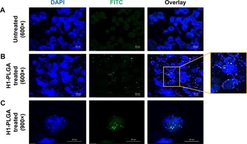 Figure 4 Confocal microscopy analysis of H1 FITC–NP internalization by THP1 macrophages.Notes: (A) Untreated control DAPI-stained THP1 cells; (B) H1 FITC–PLGA NPs treated for 4 hours and DAPI-stained THP1 cells at 600× magnification and (C) at 900× magnification in different fields showing internalized particles.Abbreviations: FITC, fluorescein isothiocyanate; NP, nanoparticle; PLGA, poly(lactic-co-glycolic acid).