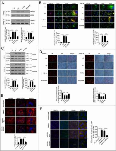 Figure 5. Downregulation of HMGB1 expression rescued HG-induced LMP. (a) HsRPE and ARPE-19 cells were transfected with siRNA-HMGB1 or Scr-siRNA and then exposed to HG for 24 h. Cell samples were processed and analyzed by immunofluorescence staining with anti-HMGB1 and anti-ACTB antibodies. ACTB was used as a protein loading control. Representative images from three independent experiments with biological and technical replicates are shown, n = 6. (b) HsRPE and ARPE-19 cells were processed as described in (A). Immunofluorescence signals after double-staining for LGALS3 (red) and LAMP1 (green) in cell samples, and Manders’ coefficients for colocalization of LGALS3 with LAMP1. Representative images from three independent experiments with biological and technical replicates are shown. Scale bars: 10 μm, n = 6. (c) HsRPE and ARPE-19 cells were processed as described in (A). Cell samples were processed and analyzed by immunofluorescence staining with anti-CTSB, anti-ACTB, and anti-LAMP1. ACTB was used as a protein loading control in the cytosolic fraction, while LAMP1 was used as a protein loading control in the lysosomal fraction. The percentage of CTSB released from lysosomes into the cytosol was analyzed. Representative images from three independent experiments with biological and technical replicates are shown, n = 6. (d) LTR staining and mean fluorescence intensity in cell samples, as assessed by fluorescence microscopy, after HsRPE and ARPE-19 cells were processed as described in (A). Scale bars: 20 μm, n = 6. (e) The RPE cells of non-diabetic, STZ-induced diabetic, STZ-induced diabetic+siRNA-Hmgb1 injected (diabetic+siRNA), and STZ-induced diabetic+Scr-siRNA injected (diabetic+Scr) rats (all the rats were fed with a regular diet) were flat-mounted and stained for HMGB1. The pictures were taken on the upper retina 100 μm away from the optic nerve. Representative images from three independent experiments with biological and technical replicates are shown. Scale bars: 10 μm, n = 10. (f) The RPE cells of non-diabetic, STZ-induced diabetic, STZ-induced diabetic+siRNA-Hmgb1 injected (diabetic+siRNA), and STZ-induced diabetic+Scr-siRNA injected (diabetic+Scr) rats were flat-mounted and stained for LGALS3 (red) and LAMP1 (green). The pictures were taken on the upper retina 100 μm away from the optic nerve, and Manders’ coefficients for colocalization of LGALS3 with LAMP1 were calculated. Representative images from three independent experiments with biological and technical replicates are shown. Scale bars: 20 μm, n = 10. ***P < 0.001.