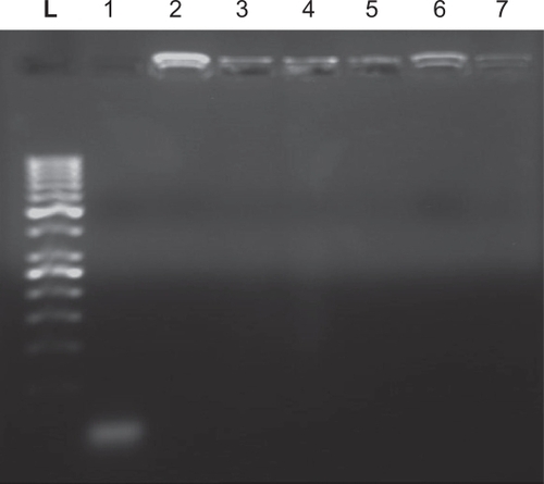 Figure 3 Gel electrophoresis analysis of alginate-chitosan nanoparticles. L (ladder), 1 (naked AS), 2 (N/P 5, one hour), 3 (N/P 5, three hours), 4 (N/P 5, three hours), 5 (N/P 25, one hour), 6 (N/P 25, three hours), 7 (N/P 25, six hours). The image has been taken after staining by ethidium bromide and visualized under ultraviolet light.