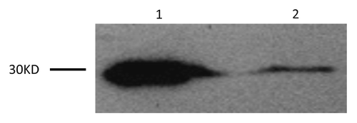 Figure 1. Western blot analysis for protein 14-3-3 in the patient’s CSF is shown in Lane 1. Lane 2 is the positive control.
