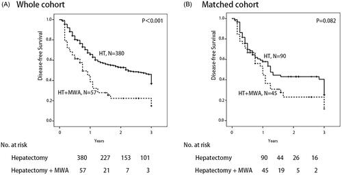 Figure 5. Disease-free survival in patients who underwent hepatectomy alone and following microwave ablation (MWA) in combination with hepatectomy: A whole cohort and B match cohort (p<.001 and p=.082, respectively) (log rank test).