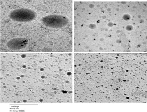 Figure 2 The optimum SPs formulation (S1) transmission electron micrograph.