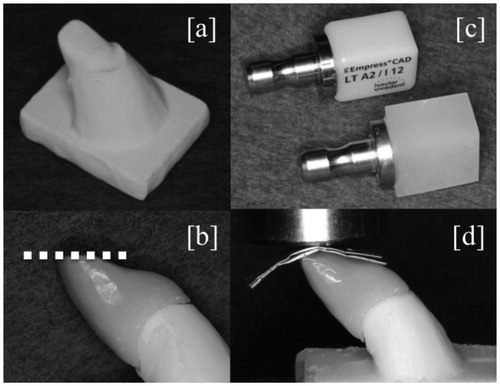 Figure 1. An experimental abutment die for crown restorations made of zirconium oxide (a). An experimental crown restoration adhered on the abutment die. A dotted line describes the non-anatomic flat surface that is created at the incisor edge of a crown restoration (b). A commercially available dental ceramic block for a CAD/CAM (upper) and an experimental all-FRC block for CAD/CAM (lower) (c). Aluminum foils were placed between the incisor edge of the crown restoration and the load cell during the fracture test (d). Abbreviations: CAD/CAM: computer-aided design and manufacturing; FRC: fiber-reinforced composite.