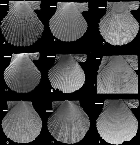 Figure 12.  Young specimens of Pectinidae. Scale lines 0.5 mm. (A) Talochlamys pusio, Strait of Gibraltar, Ceuta, depth 20–40 m, (SMNH 59345). (B) Talochlamys pusio, Acores, Sao Miguel, depth 15–22 m (SMNH 59346). (C) Talochlamys pusio, western Norway, Korsfjord, 276–256 m (SMNH 55505). (D) Talochlamys multistriata, Strait of Gibraltar, Ceuta, depth 9–10 m (SMNH 56215). (E) Talochlamys multistriata, Strait of Gibraltar, Ceuta, depth 16–25 m (SMNH 57226). (F) Mimachlamys varia, Sweden, Bohuslän, Gullmarsfjord (SMNH 54319). (G) Pseudamussium sulcatum, western Norway, Korsfjord, depth 260–250 m (SMNH 20130). (H) Pseudamussium peslutrae, BIOICE#2393, off southwestern Iceland, depth 291 m (SMNH 55502). (I) Mimachlamys varia, Strait of Gibraltar, Ceuta, depth 16–25 m (SMNH 20577).