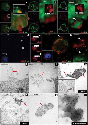 Figure 3. Visualization of extracellular sEVCs in HT29 colorectal carcinoma cell line (a) Confocal (CD63: red, E-cadherin: green), (b) HyVolution (ALIX: red, E-cadherin: green) and (c) HyVolution (ALIX: red, CK: green) images of HT29 cell-derived sEVCs. Arrowhead points to a cytoplasmic process in C. Scale bars: 500 nm. The inserts of (b) and (c) show STED microscopic images of the sEVCs (scale bars: 500 nm). (d–g) sEVCs in cell-free regions of HT29 culture. Scale bar: 50 µm (d). (h-j) ALIX/RAB7 co-staining of extracellular MVB-like sEVCs (arrowheads; scale bars: 5 µm (h), 2 µm (i and j)). (k, l) EM images show MVB-like sEVCs as large, membrane enclosed (arrows) structures close to the cell with internal vesicles in the size range of sEVs (~100–160 nm). Scale bars: 500 nm. (m, n) Membrane enclosed (arrows) MVB-like sEVCs contain ALIX positive (DAB staining) spheres close to HT29 cells (inserts). Scale bar: 500 nm and 1 µm, respectively, inserts: 2 µm and 1 µm respectively. (o) A membrane enclosed (arrow) MVB-like sEVC and (p) an ALIX (5 nm gold)/RAB7 (9 nm GOLD) positive MVB-like sEVC isolated from the conditioned media of HT29 cells. Scale bars: 500 nm and 200 nm, respectively.