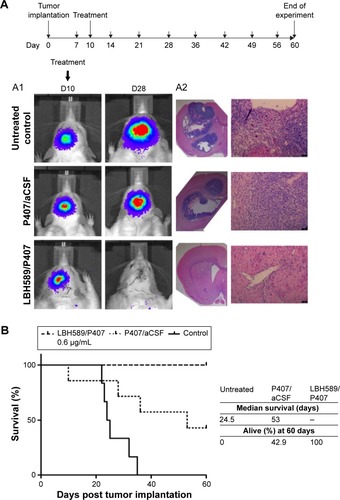 Figure 6 In vivo efficacy of LBH589/P407 after a single administration by CED in the syngeneic Fischer344/F98-Luc orthotopic rat glioma model.Notes: Animals with visible tumor bioluminescence were treated on day 10 after stereotactic implantation of 105 luciferase-expressing F98 glioma cells into the left striatum (large arrows on schematic). All animals had weekly scans when alive (small arrows). (A) Bioluminescent imaging revealed a loss of transcranial bioluminescence in treated animals compared to controls (A1) and no evidence of tumor histologically post mortem or post sacrifice (A2 H&E). (B) Kaplan–Meier survival analysis of a 60-day experimental period showed a significant survival advantage in treated animals compared to untreated and vehicle-only controls (eight animals per group, log-rank test, P<0.001). All the treated animals (100%) survived.Abbreviations: CED, convection enhanced delivery; H&E, hematoxylin and eosin; P407, poloxamer 407.