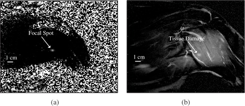 Figure 6. (a) Coronal phase subtraction image showing the pre-treatment location of a focal zone in dog's thigh. (b) T2 weighted turbo spin echo coronal image taken near the center of the dog's thigh.