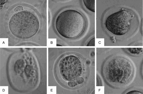 Figure 2.  Morphological images of M II oocytes (×400). Compared to the control (A), the morphological abnormalities of M II oocytes were observed in mice exposed to molybdenum at ≥20 mg/L, such as no first polar body (B), distorted cytoplasm (C), transformative zona pellucida and excessive vacuolization (D), shrunken cytoplasm (E), and centrally severe granulation (F).