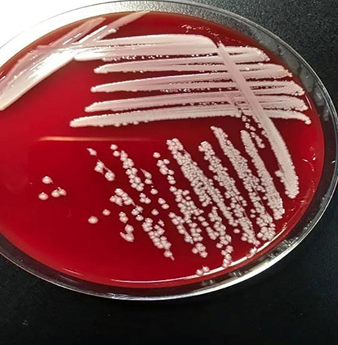 Figure 2 Bacteria colony of Pandoraea species cultured on Columbia blood plate for 48 hours.