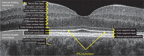 Figure 1 Layer-by-layer B-scan SD-OCT display of normal retina.