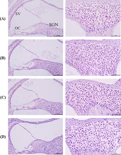 Figure 9. Histological sections of inner ear samples of mice after intratympanic injection. H&E staining was performed on inner ear sections from mice of (A) control group, (B) TA-Sol group, (C) TA-ME group, and (D) TA-MEG (n = 3 each group). OC, organ of Corti; SGN, spiral ganglion neuron; SV, stria vascularis. In each of the low-magnification images (right panel), a dotted-line rectangle shows where a high-magnification image of the spiral ganglion cells (right panel).