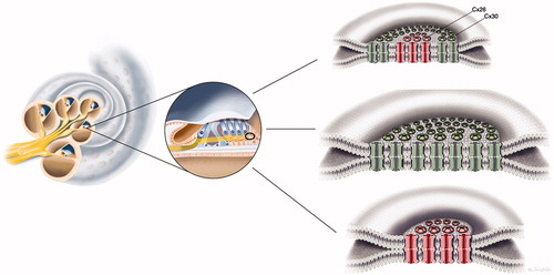 Figure 7. Illustration of gap junction (GJ) plaques in the human organ of Corti. GJ plaques may exist as Cx26 or Cx30 protein homomeric/homotypic aggregates. Some GJ plaques appeared to contain both isotypes. From this experiment, it was not possible to verify whether single plaques consisted of both molecular arrangements (‘hybrid plaque’) or whether separate homomeric GJ plaques were just in close juxtaposition.