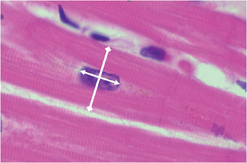 Figure 1. An example of a high-power field of a myocyte in the left ventricle used for assessing myocyte nuclear length/size (arrows), and myocyte diameter (diamonds).