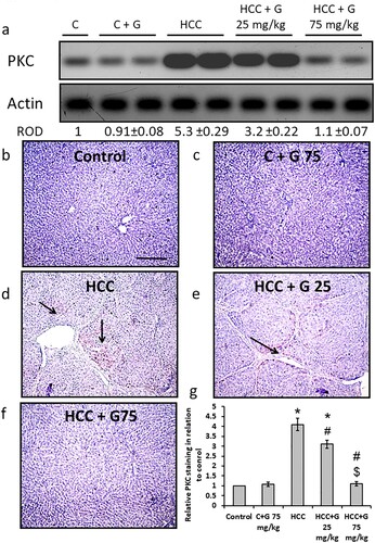 Figure 9. Effect of genistein at 25 and 75 mg/kg on hepatic PKC protein expression levels in TAA-induced HCC rats. (a) PKC protein expression levels were determined via western blotting. Photomicrographs of immunohistochemically stained hepatic sections using anti-PKC antibodies in the following groups: (b) Control group; (c) control group treated with genistein at 75 mg/kg; (d) HCC group; (e) HCC rats treated with 25 mg/kg genistein; and (f) HCC rats treated with 75 mg/kg genistein. (g) Relative immune-staining score of PKC showing increase in HCC sections that was reduced by genistein treatment. Scale bars, 50 µm. *P < 0.05 vs. control group; #P < 0.05 vs. HCC group; $P < 0.05 vs. HCC + 75 mg/kg genistein group. PKC; protein kinase C; TAA, thioacetamide; HCC, hepatocellular carcinoma; C, control; G, genistein.