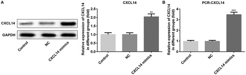 Figure 1. Protein (A) and mRNA (B) expression levels of CXCL14 after overexpression of CXCL14 in TCA-8113 cells. (A) The protein expression level of CXCL14 was determined by Western blot. (B) The mRNA expression level of CXCL14 was measured by qRT-PCR. **P < 0.01, ***P < 0.001 versus NC. NC, negative control. All results were confirmed in at least three independent experiments.