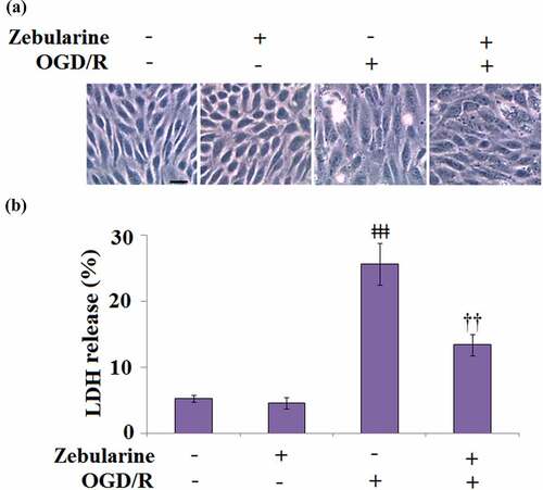 Figure 5. Zebularine prevented OGD/R-induced release of LDH in Bend.3 brain endothelial cells. Cells were exposed to OGD/R with Zebularine (20 μM). (a). Morphology of Bend.3 brain endothelial cells; Scale bar, 50 μm; (b). Release of LDH was assayed (ǂǂǂ, P < 0.001 vs. sham; ††, P < 0.01 vs. OGD/R, N = 5).