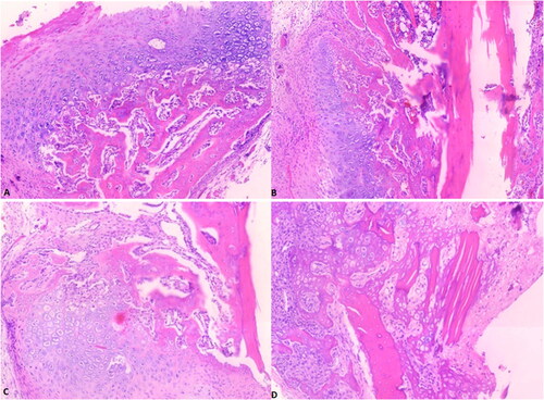 Figure 3. Histopathologic image of rat tibia, H&E stain, X100, (a)- sham group with bone healing score 5 (predominantly chondroid tissue with slightly immature bone). (B, C)-RM group with bone healing score 6 (Equal amounts of chondroid and immature bone); (D) -R4 group with bone healing score 10 (healing with mature bone). Scale bar = 100µm (The rats were assigned into three groups (sham group, and two experimental group named R4 and RM). In the first experimental group, R4, the right tibia of the rats were exposed to 4 Hz PEMF with a magnetic field amplitude of 10 mT, while the right tibia of the rats in the second experimental group, RM, were exposed to PEMF with multi frequencies, consecutively, 220 Hz, 727 Hz, 880 Hz and 10 kHz, with a magnetic field amplitude of 10 mT for 1 h/day (7 days in a week) during 1 month).