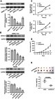 Figure 2 HOXA10 knockdown inhibited HCC cell proliferation both in vitro and in vivo.Notes: (A) HOXA10 protein levels were detected by Western blot in five HCC cell lines. (B) SMMC-7721 and HepG2 cells were transfected with HOXA10 shRNA (shHOXA10#1, #2 and #3) or scramble shRNA (shNC). HOXA10 protein was examined by Western blot. (C) CCK-8 assays of SMMC-7721 and HepG2 cells after transfected with shHOXA10#3 or shNC for 24, 48 and 72 h. (D) SMMC-7721 cells stably expressing shHOXA10#3 or shNC were injected subcutaneously into the nude mice. Tumor volume was measured every 3 days for 33 days. (E) On Day 33, tumors were harvested and weighed. **P<0.01 and ***P<0.001 compared to shNC.Abbreviations: HOXA10, homeobox A10; HCC, hepatocellular carcinoma; shRNA, short hairpin RNA; shNC, negative control shRNA; CCK-8, cell counting kit-8.